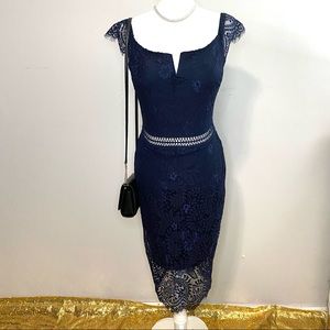 Night Blue Lace Dress! 💙